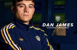 竞彩网首页-利兹联青训输出(利兹联阵型)