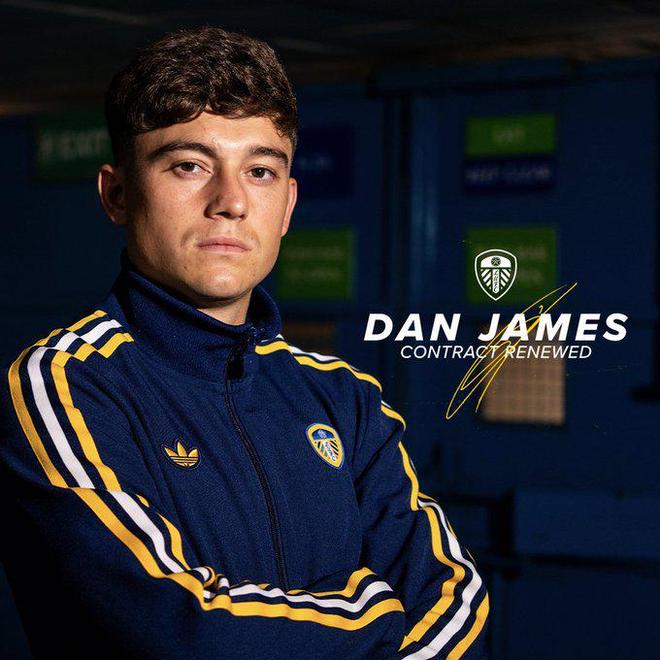 利兹联青训输出(利兹联阵型)